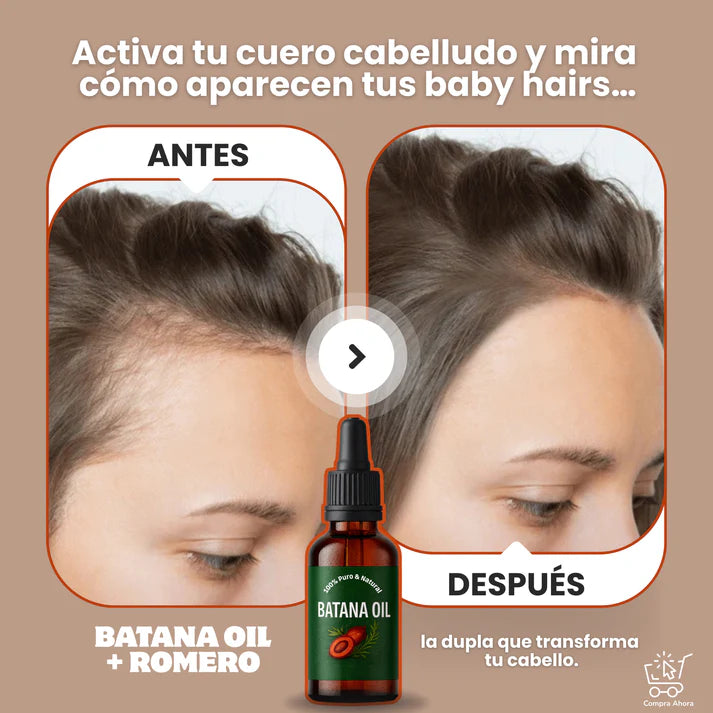 No más caída del cabello, recupera tu confianza
