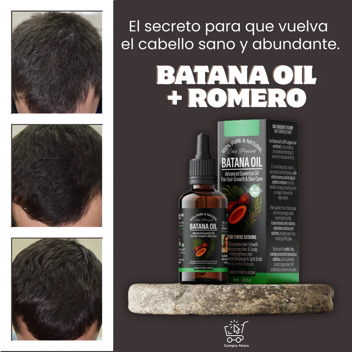 No más caída del cabello, recupera tu confianza